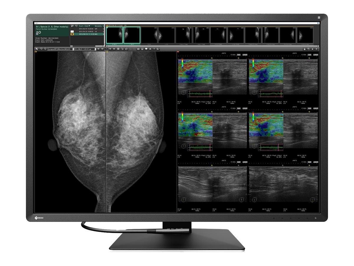 EIZO RadiForce RX1270 31" 31" 31" 31" IPS IPS IPS IPS 4200 x 2800 pixel 4200 x 2800 pixel 4200 x 2800 pixel 4200 x 2800 pixel HDMI DisplayPort HDMI