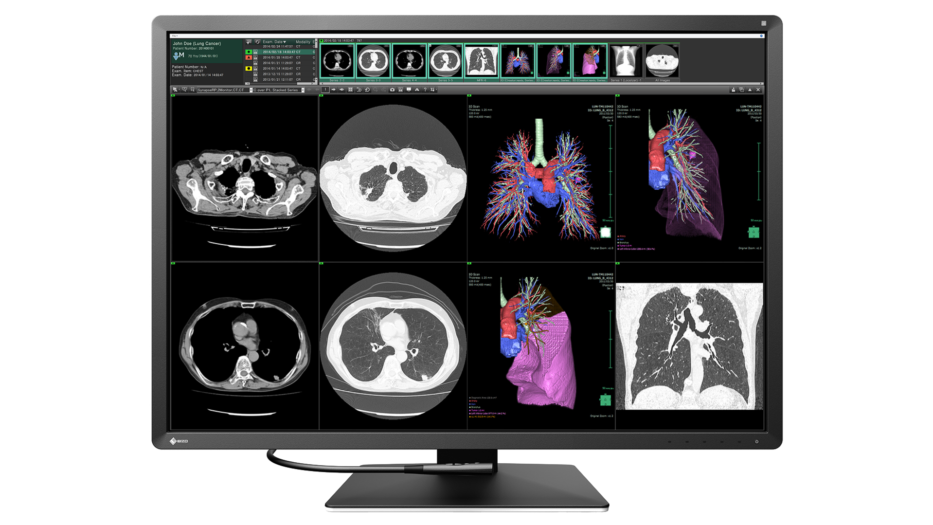 EIZO RadiForce RX1270 31" 31" 31" 31" IPS IPS IPS IPS 4200 x 2800 pixel 4200 x 2800 pixel 4200 x 2800 pixel 4200 x 2800 pixel HDMI DisplayPort HDMI